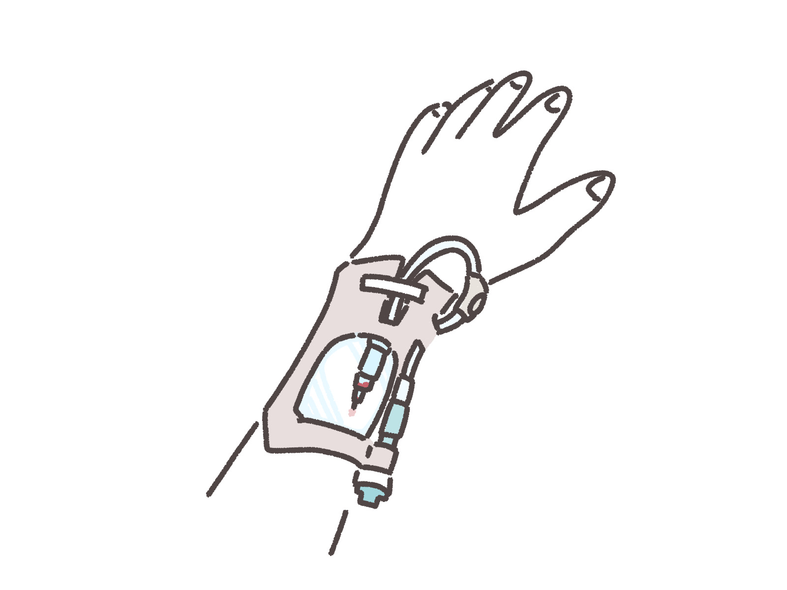 フラッシュはヘパリンロックと生理食塩液のどちらが良い？