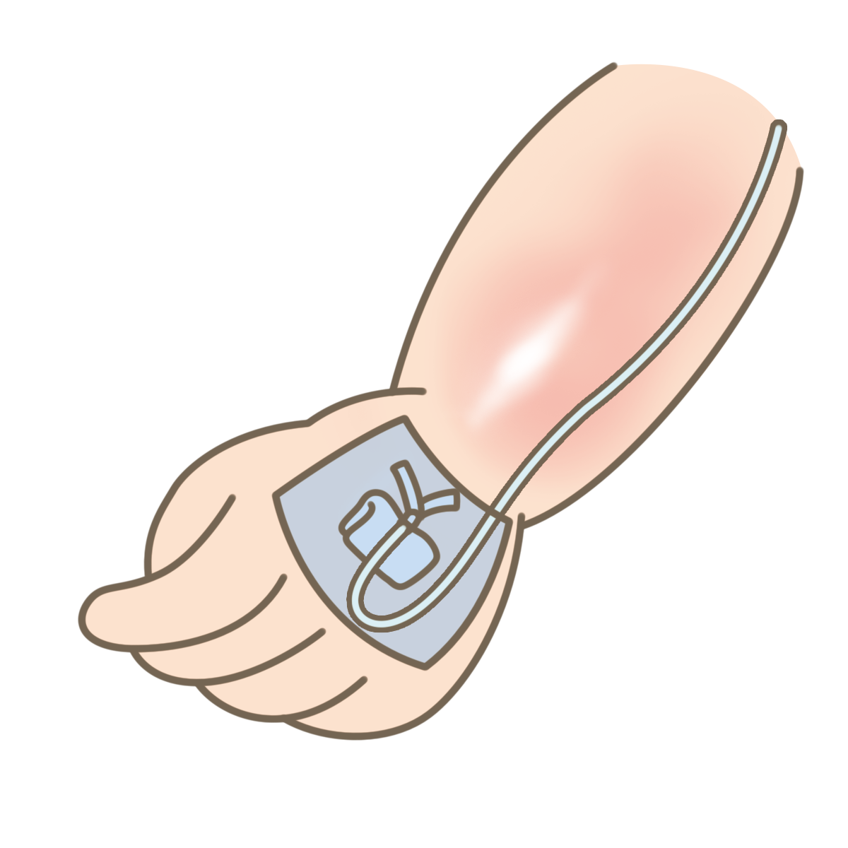 滴下が漏れる理由